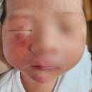 산부인과서 생후 4일 된 신생아 얼굴에 멍 자국·상처…CCTV 없어 경위 파악 어려워 이미지