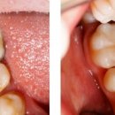 서울앤치과 이미지