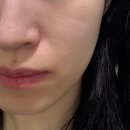 역삼1-204 | [선릉 에스테틱] 라피네 스킨앤바디 피부 관리 후기😌