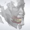 미라클원