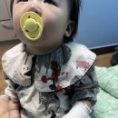 아기 돌발진 이야기 #백혈구감소증 #고열지속 #호중구감소 #백혈구수치 #역격리 #양부대 #양산부산...