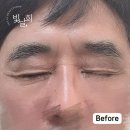 삼계남성경로당 | [마산내서읍눈썹]처진 남자눈썹을 호감형 눈썹으로 수정