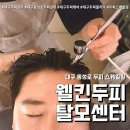 대구동성로 두피관리 개선 후기(feat. 웰킨두피탈모센터 두피케어 )