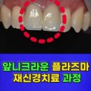 걸포탑치과의원 네이버블로그