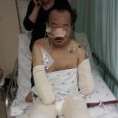 병원에서 의료사고로 친구의 친구 아버지 팔다리와 코를 잘라냈습니다. (사진주의) 이미지