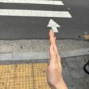 엄지이불 | 관악구 서울센트럴병원 엄지손가락/손바닥 종양 수술 후기