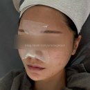 대구죽곡초등학교 | 달서구피부관리 “ 오늘은스킨 ” 웨딩 탄력 케어 물방울리프팅 후기