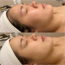 비나인에스테틱 이미지