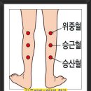 부항요법의 명칭&amp;뜨는법 이미지