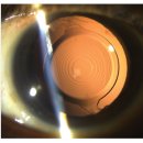 굿피플안경원 이미지