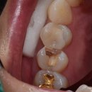 정도치과기공소 이미지