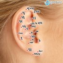 이혈 테라피 이미지