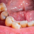 J Dental Lab 사이언스데일리
