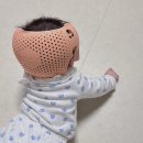 비바의원 | 단두수치 98 아기의 두상교정헬멧 픽업후기 (비바헬멧 위례센터)