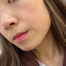 순뷰티클럽 | 노원 화이트 태닝 얼짱몸짱뷰티클럽 노원점에서 화이트 태닝 받고 온 후기!