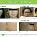 에이스휴먼 이미지
