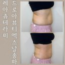 엑스날XNAL송파 | 송파 레아쥬 뱃살관리 드로아뷰티 엑스날 송파점 후기