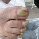 레푸스 앤 두두네일 | 의정부 문제성 발톱 관리 전문샵 [레푸스 앤 두두뷰티] 후기