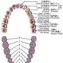 풍치(만성치주염) 이미지