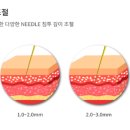 시크릿의원 이미지