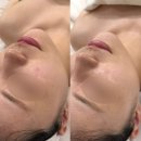청주 강서동 피부관리 [ 스파나인 ] 하이드라9 후기, 가격