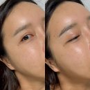 아이원헬스케어 | 촉촉한 아이원 일라이트 보습크림