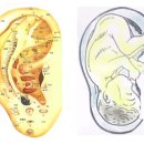 귀건강(이혈테라피) 이미지