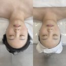 보니토에스테틱 이미지