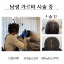 모채움스칼프