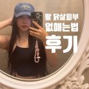 비아한의원 | 겨드랑이 모공각화증 없애는법