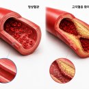 동백팜 | 내돈내산 한스팜 비타민C 2000mg 구매 후기 이왕재 박사 복용법 정리