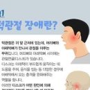 턱관절 장애 및 (턱통증 턱근육통증 턱소리) 이미지