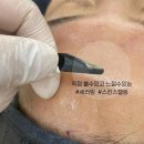 뉴세라