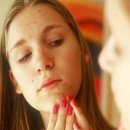 스킨룩스한의원 | 여드름 원인과 치료후기