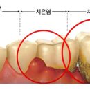 경북대학교 치의학전문대학원 | 광교/상현역/웃음꽃피는치과/ 치주 전문 최성민원장님 🫶