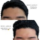 트윙클왁싱 이미지
