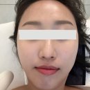 성남피부관리 이레바디스킨. 기기로 데콜테관리 수기로 얼굴관리를 기분 좋게 할 수 있는 곳