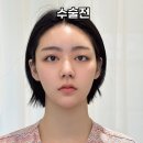 아이그램성형외과 이미지