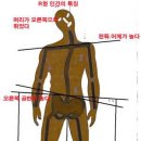 왼쪽 다리가 긴 증상 & 오른쪽 다리가 긴 증상 이미지