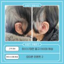 스타키보청기 중구센터 이미지