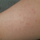 관악우태하피부과의원 이미지