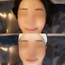 덕진-105 | 전주하가지구피부관리, 나이스바디&amp;스킨 콜라겐 볼륨리프팅 관리 후기