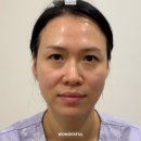 원더풀의원 | 눈썹하거상 수술 당일부터 한달 후기