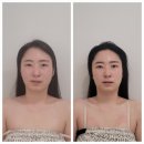 앤이샘 에스테틱 | 대구 달서구 신부관리 신부마사지 "앤이샘에스테틱" 새얼굴 테라피(윤곽관리) 받고 왔어요