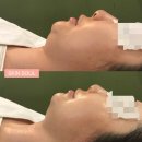 [공지] 일산 주엽 스킨소울 운영 철학, 블로그 체험단도 1회 체험 후 티켓팅할 수밖에 없는 이유