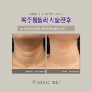 비앤에스 이미지