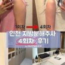 더 흐름 | 인천 지방분해주사 4회차 후기 | 팔뚝라인, 빠지는 흐름이 더 또렷해졌어요