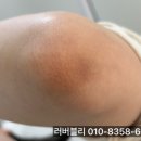 예신 티스토리
