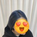 러브썸독 | 여자 가르마탈모 smp두피커버 의정부 포인트닷스칼프&amp;립 3차후기