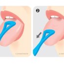 수클리너 이미지